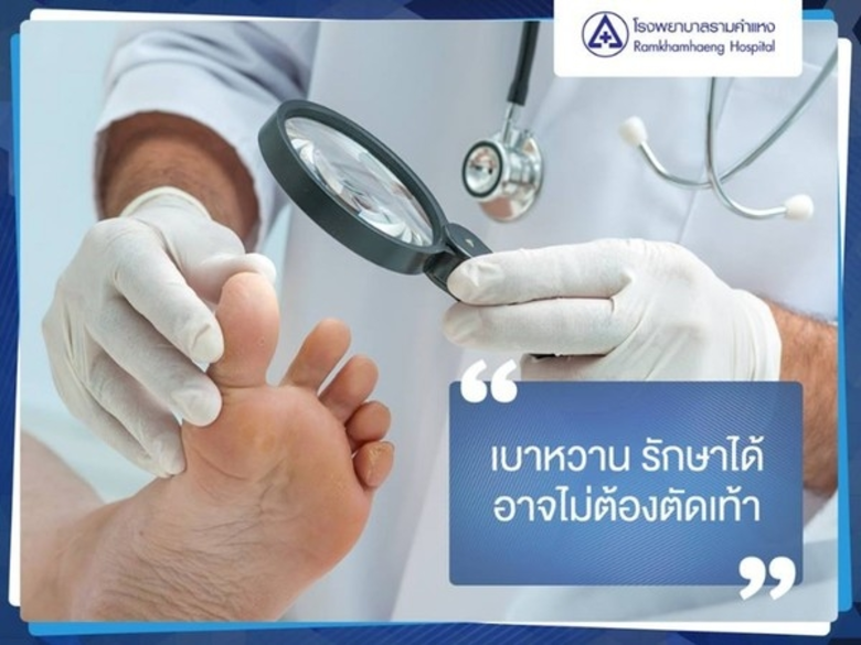 เป็นแผลเบาหวานต้องตัดเท้า? จะตัดทำไมในเมื...