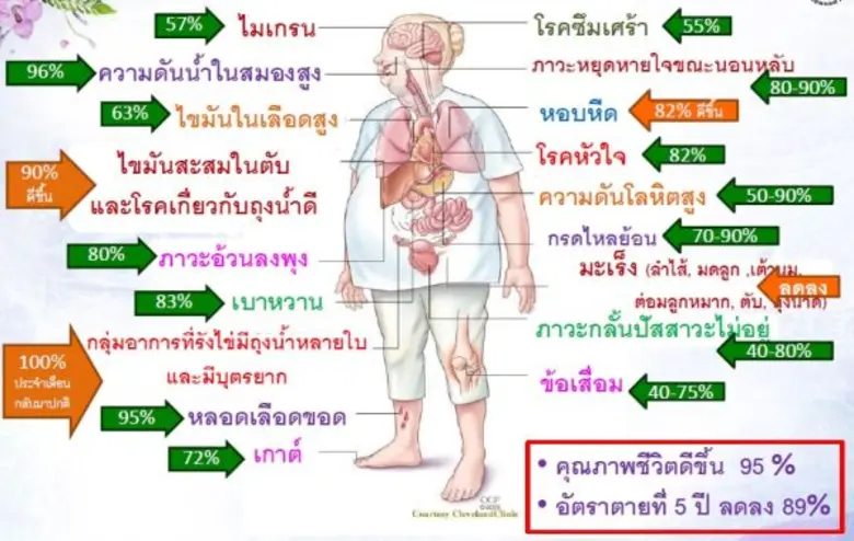 คณะแพทยศาสตร์ มหาวิทยาลัยสงขลานครินทร์ จั...