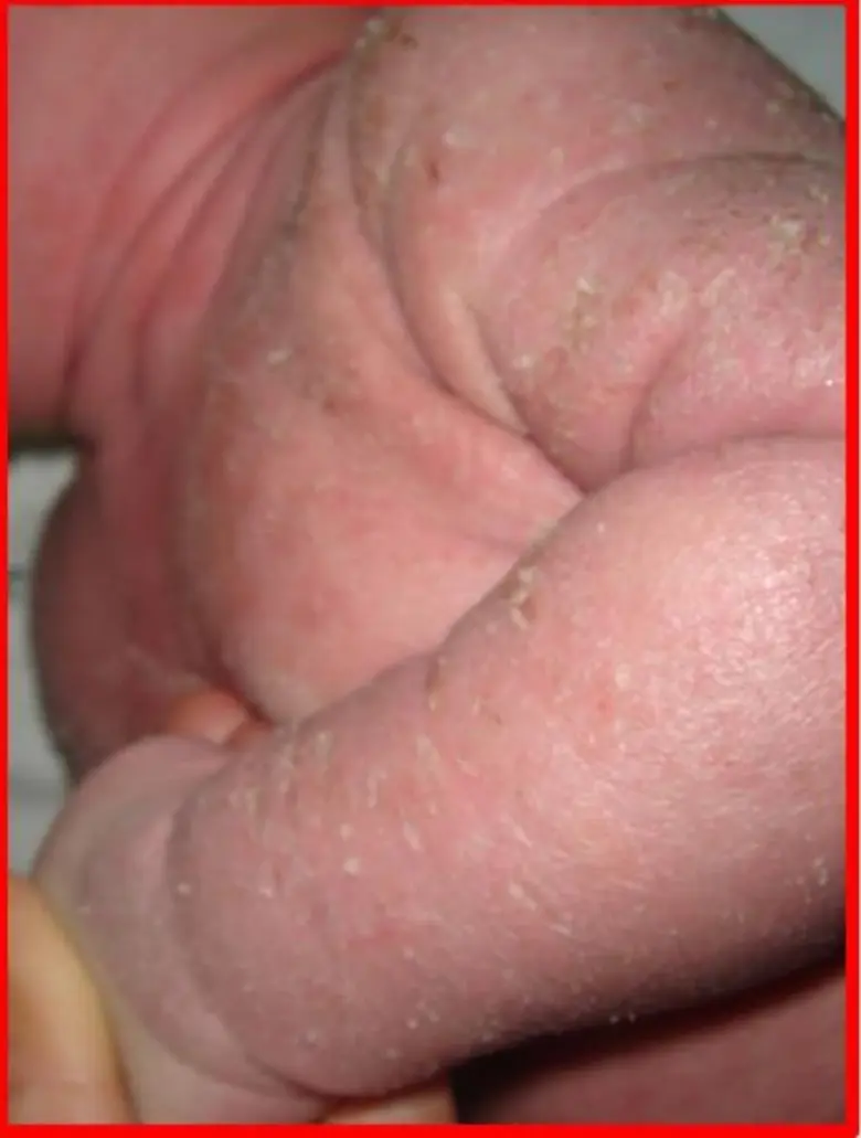 บทความโดย พ.อ.หญิง พญ.ปาจรีย์ ฑิตธิวงษ์ ก...