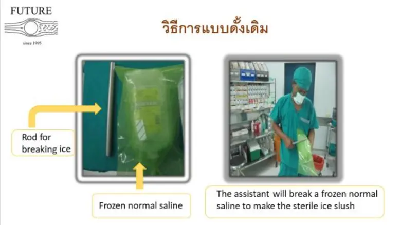 น้ำแข็งเพื่อการผ่าตัดเปิดช่องอก ฝีมือเด็กวิศวะเครื่องกล มจธ.