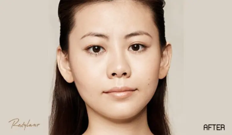 นวัตกรรมใหม่ล่าสุด ฟื้นฟูผิวให้กลับมาเปล่งปลั่ง เติมเต็มความชุ่มชื่น และลดเลือนริ้วรอยอย่างเร่งด่วน Baby Skinboosters