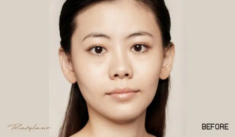 นวัตกรรมใหม่ล่าสุด ฟื้นฟูผิวให้กลับมาเปล่งปลั่ง เติมเต็มความชุ่มชื่น และลดเลือนริ้วรอยอย่างเร่งด่วน Baby Skinboosters