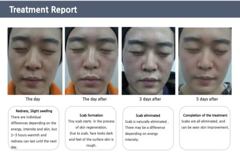 ถ้าคุณเป็นคนที่มีผิวสวย สดใสดูสุขภาพดี คุ...