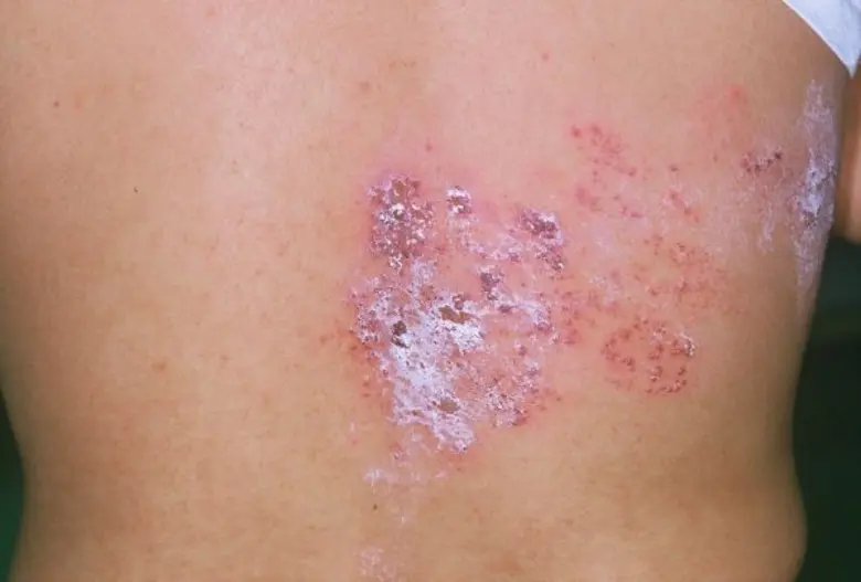 ช่วงฤดูฝนนี้มีแต่ข่าวเรื่องของงูเลื้อยเข้...