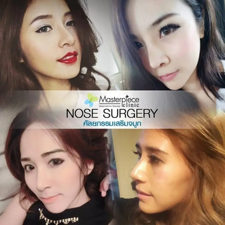 อยากได้ดั้งฟรีมาสเตอร์พีซมีแจก! ลุ้นเสริมจมูกฟรี 3 รางวัล!!