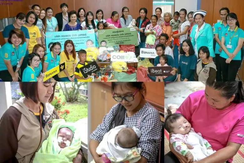 คอมเซเว่นฯ สร้างรอยยิ้มแก่สังคม เดินหน้าช่วยเหลือกเด็กพิการปากแหว่งเพดานโหว่ กับโครงการ “ยิ้มสดใสจากใจคอมเซเว่น”