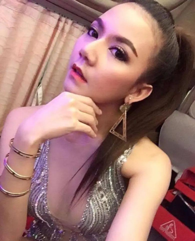 จ๊ะ-อาร์สยาม หวั่นอัมพาต แพทย์พบเส้นเลือดสมองหดตัว