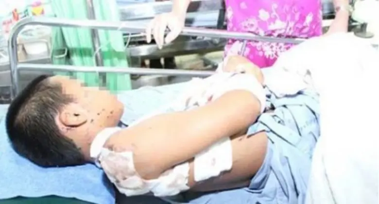 สคร.10 อุบลฯ เตือนภัยจากการจุดประทัดช่วงเ...