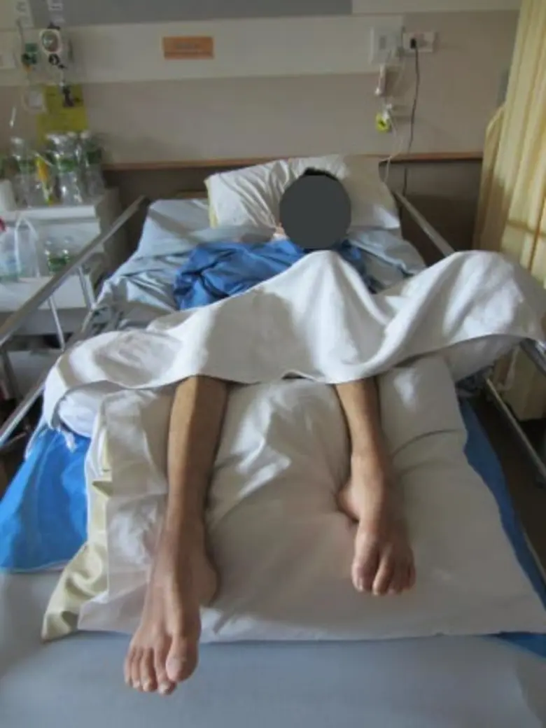 สคร.10 อุบลฯ เผย พบผู้เสียชีวิตด้วยโรคหลอดเลือดสมองเพิ่มขึ้นเรื่อยๆ แนะประชาชนให้ความสำคัญ ตระหนักถึงอาการเบื้องต้น