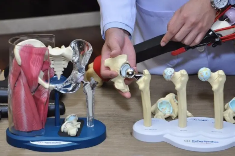 รพ.กรุงเทพ ชูเทคนิคผ่าตัดเปลี่ยนข้อสะโพกเทียม แบบไม่ตัดกล้ามเนื้อด้วยเทคนิคซ่อนแผลผ่าตัด เจ็บน้อย ฟื้นไว เคลื่อนไหวสะดวก