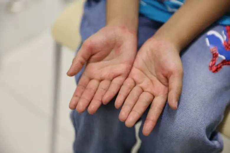 4 สารตกค้างใกล้ตัว น่ากลัวกว่าที่คิด ภัยร้ายในผลิตภัณฑ์ดูแลผิว อันตราย…หากใช้ในปริมาณเกินกำหนด!!