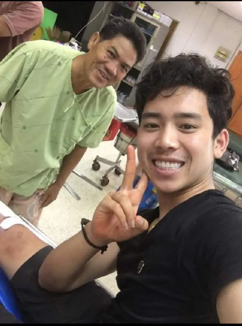 ฟาดเคราะห์แรง!! เบิ้ล ปทุมราช เกิดอุบัติเหตุ ขับมอเตอร์ไซค์ล้ม ขา กระแทกพื้น เลือดไหลอาบ แพทย์รอดูอาการ