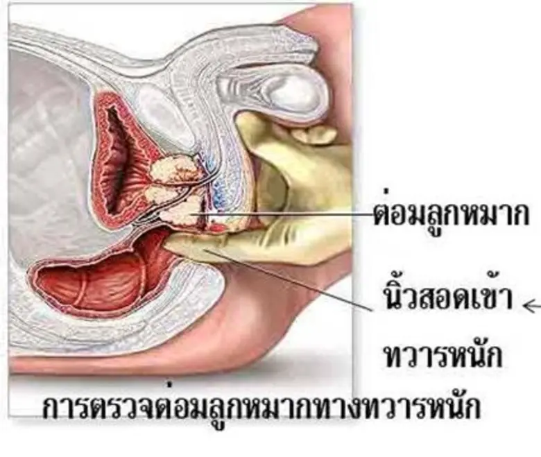 ศูนย์โรคระบบทางเดินปัสสาวะกรุงเทพ โรงพยาบ...