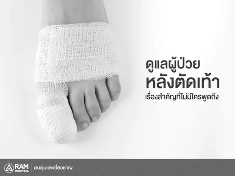 เป็นที่รู้กันดีว่าแผลของผู้ป่วยเบาหวานนั้นใช้ระยะเว...