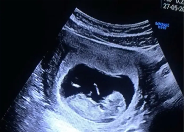 กรี๊ดเบอร์แรง ยินดีกับ ดีเจดร.อั๋น ภูวนาท...