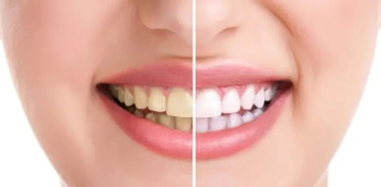 5 สัญญาณ ที่คุณควรตรวจเช็ค ก่อนปัญหาในช่องปากจะลุกลาม