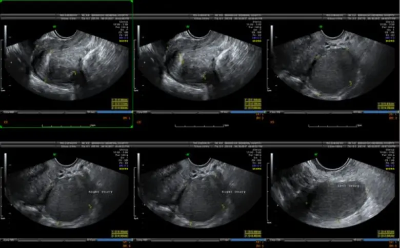 “3 โรค” ซุกซ่อนภายในผู้หญิง ระเบิดเวลาที่เกิดได้