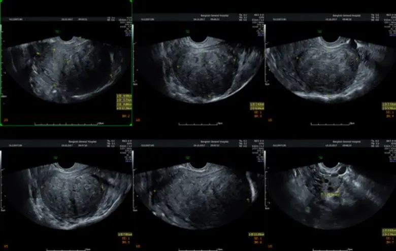 “3 โรค” ซุกซ่อนภายในผู้หญิง ระเบิดเวลาที่เกิดได้