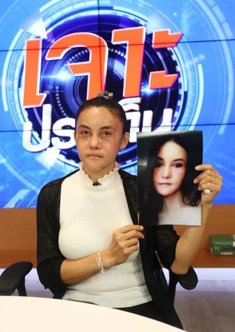 ศัลยกรรมทำพิษ “ฟางฟาง-ม๊กจ๊ก” อดีตดาราตลก ชีวิตพัง สามีทิ้ง เกือบฆ่าตัวตาย