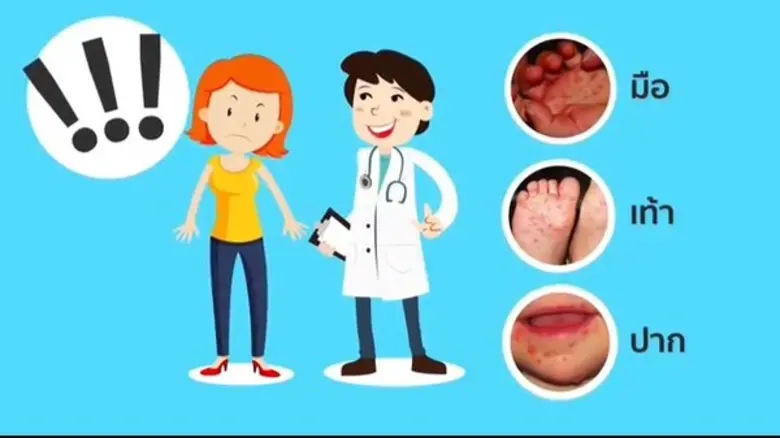 ดูแลใส่ใจ ลูกหลานห่างไกลโรคมือ เท้า ปาก