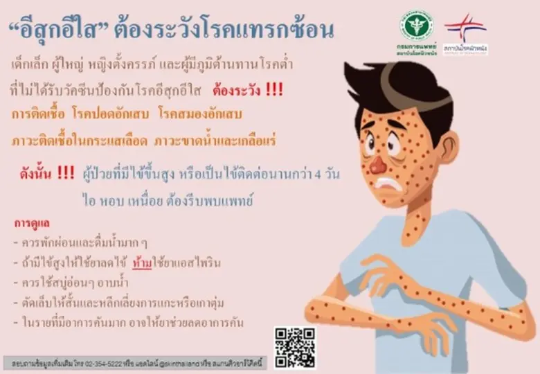 MED HUB NEWS ถ้าพูดถึงโรคในช่วงฤดูฝนต่อเน...