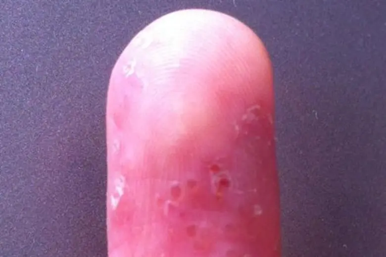 ศ. นพ. ประวิตร อัศวานนท์ ประชาสัมพันธ์สมา...