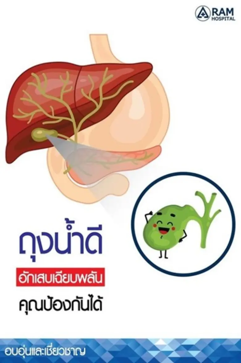 ถุงน้ำดีมีหน้าที่หลักในการเก็บสำรองน้ำดีท...