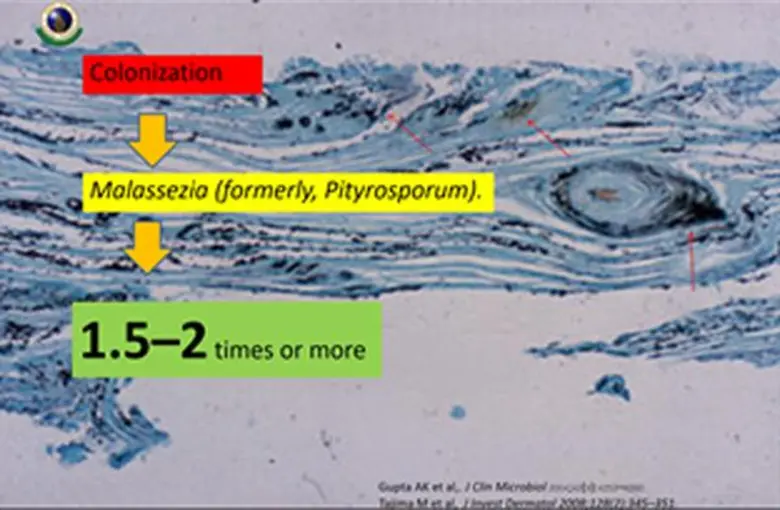 โดย รศ.นพ.รัฐพล ตวงทอง ปฏิคมและแพทย์ผู้เช...