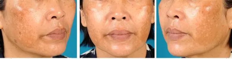 โดย รศ.พญ. รังสิมา วณิชภักดีเดชา ประชาสัม...