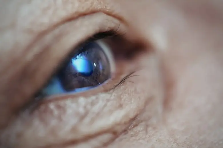 วุ้นตาเสื่อม (Vitreous degeneration)