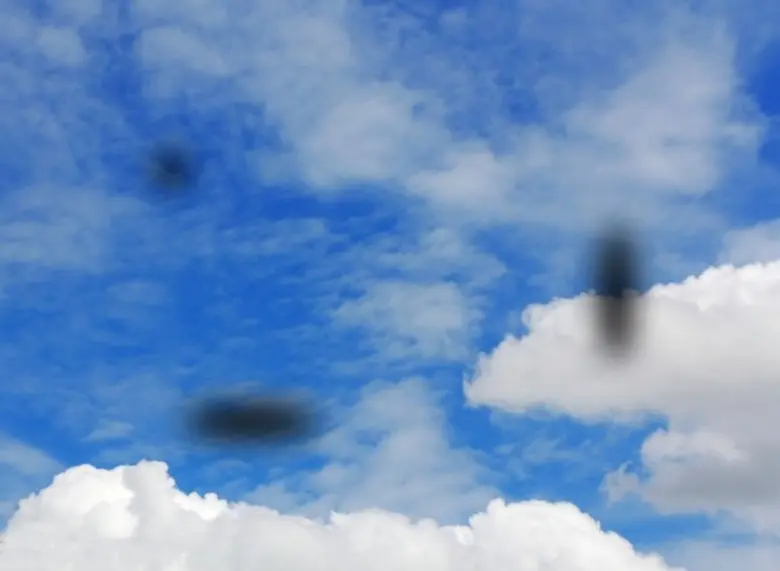 วุ้นตาเสื่อม (Vitreous degeneration)