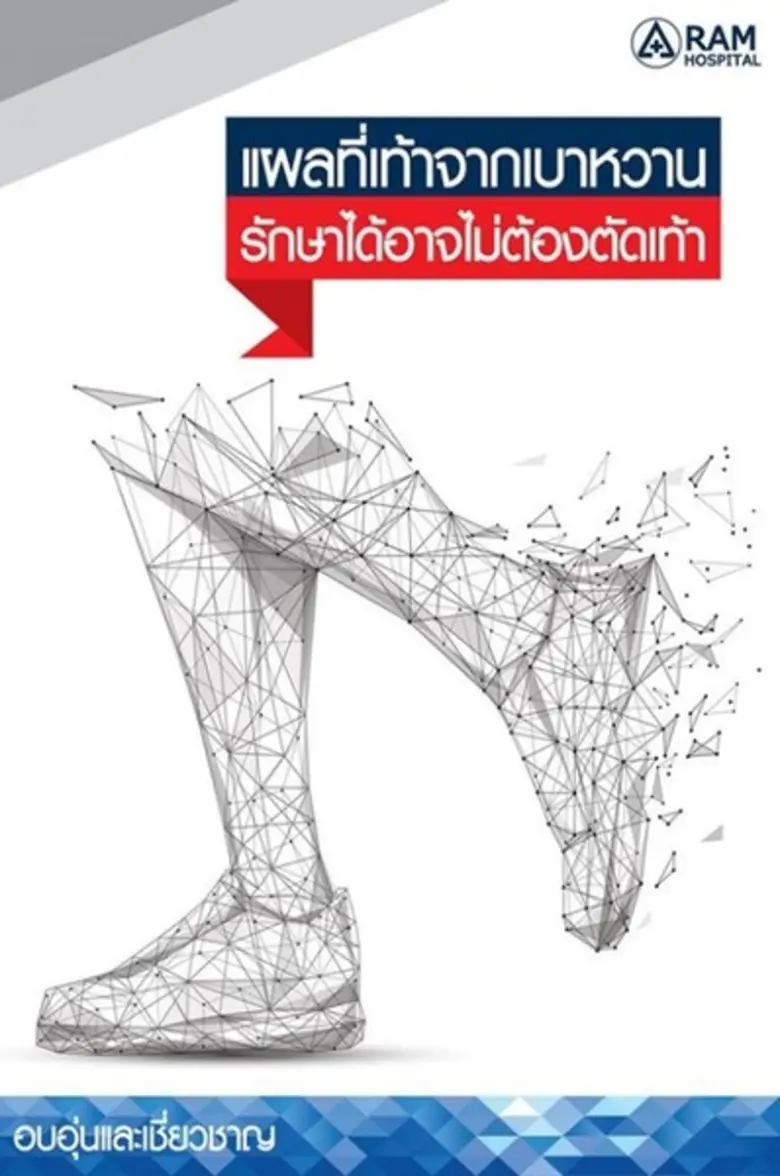 ในผู้ป่วยเบาหวานมักมีภาวะหลอดเลือดที่ขาตี...