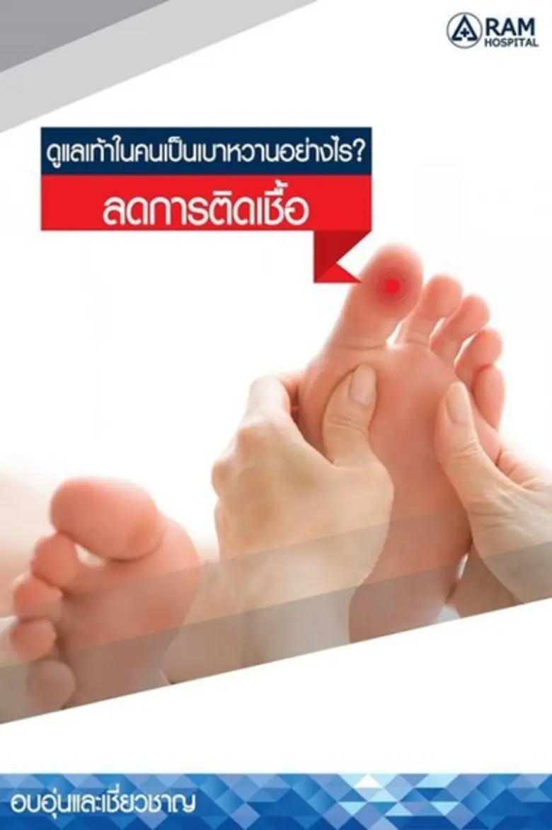 การดูแลรักษาแผลของผู้ป่วยเบาหวานนั้น สิ่งสำคัญที่สุ...