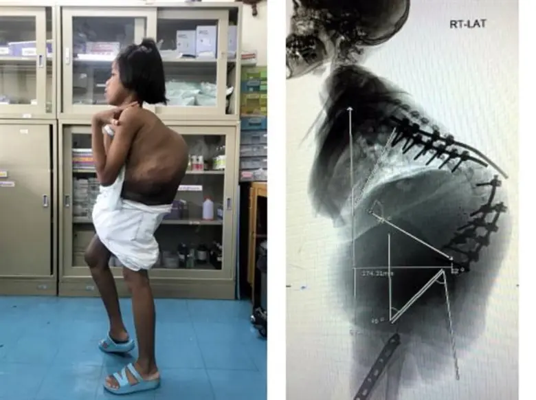 โรงพยาบาลราชวิถี โดยกลุ่มงานออร์โธปิดิกส์...