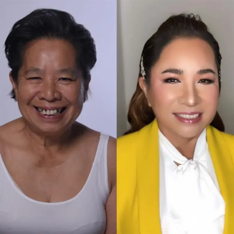 หลังจากประสบความสำเร็จกับการทำศัลยกรรมจนต...