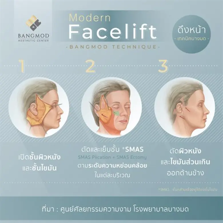 ศัลยกรรมเมืองไทยโตสวนกระแสเศรษฐกิจ ต่างชาติยืนหนึ่งแห่จองคิวทำศัลยกรรม