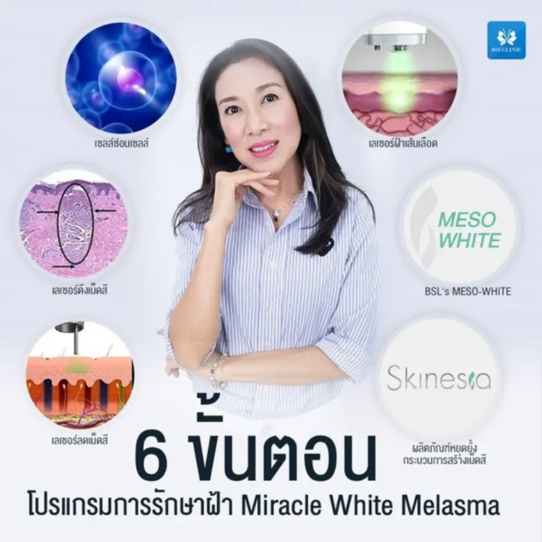 ฝ้า คือรอยคล้ำหรือรอยดำ ที่ขึ้นเป็นปื้นๆ ...