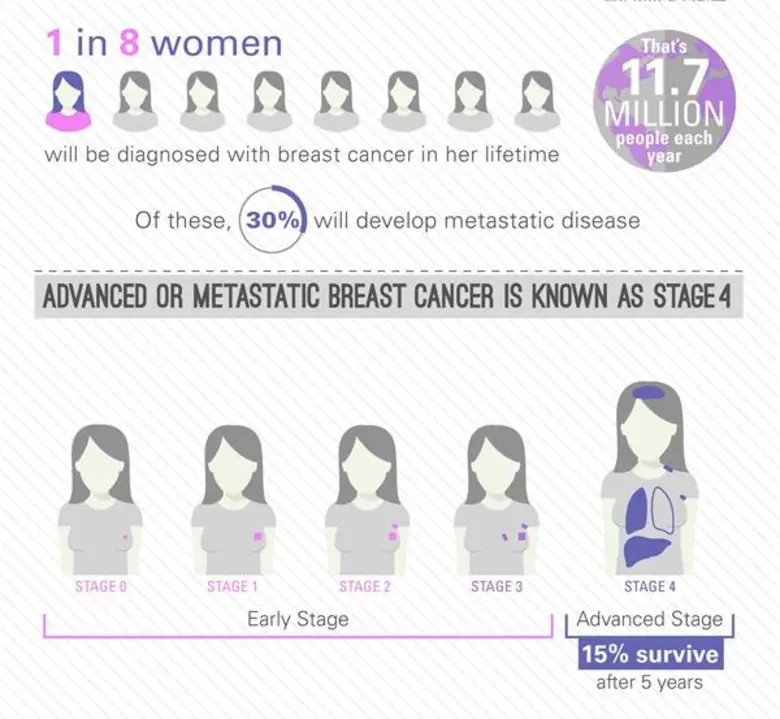 "มะเร็งเต้านม" ถือเป็นภัยเงียบสำหรับผู้หญ...