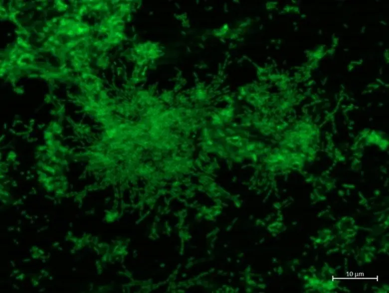นักวิจัย มจธ.พัฒนาอุปกรณ์ของไหลแบบไมโคร ศึกษาพฤติกรรมการเกิดฟิล์มของจุลินทรีย์เพื่อการผลิตก๊าซชีวภาพ