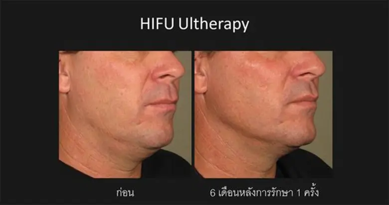 ศ. นพ.วรพงษ์ มนัสเกียรติ ประธานวิชาการสมา...