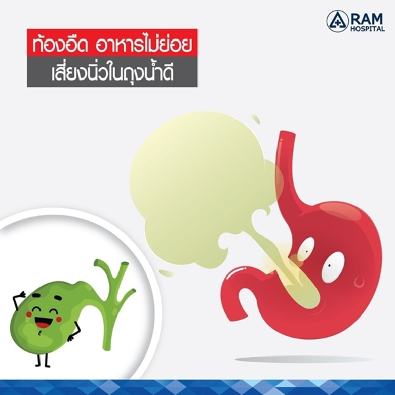 นิ่วในถุงน้ำดี เป็นโรคที่ป้องกันได้ยาก เน...