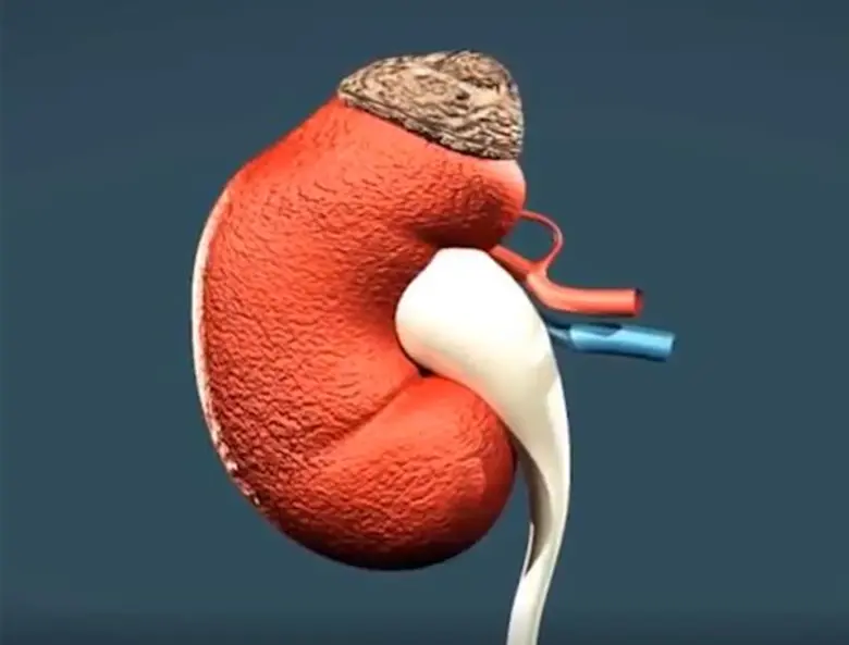 คัดกรอง ป้องกัน รู้ทัน โรคไต