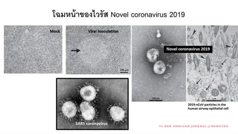 ปอดบวมจากอู่ฮั่น: ประเทศไทยจุดไหน “ใช่พอดี”