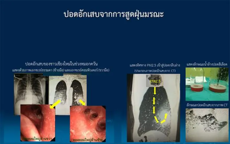ราชวิทยาลัยอายุรแพทย์ฯห่วง ! จากกรุงเทพฯถึงเชียงใหม่ค้นหาความจริงฝุ่นพิษมรณะ PM2.5