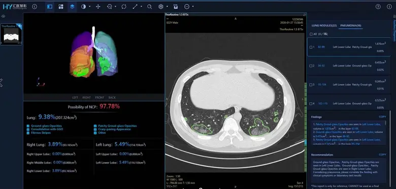 หัวเว่ยส่งมอบบริการด้านเทคโนโลยี AI การปร...