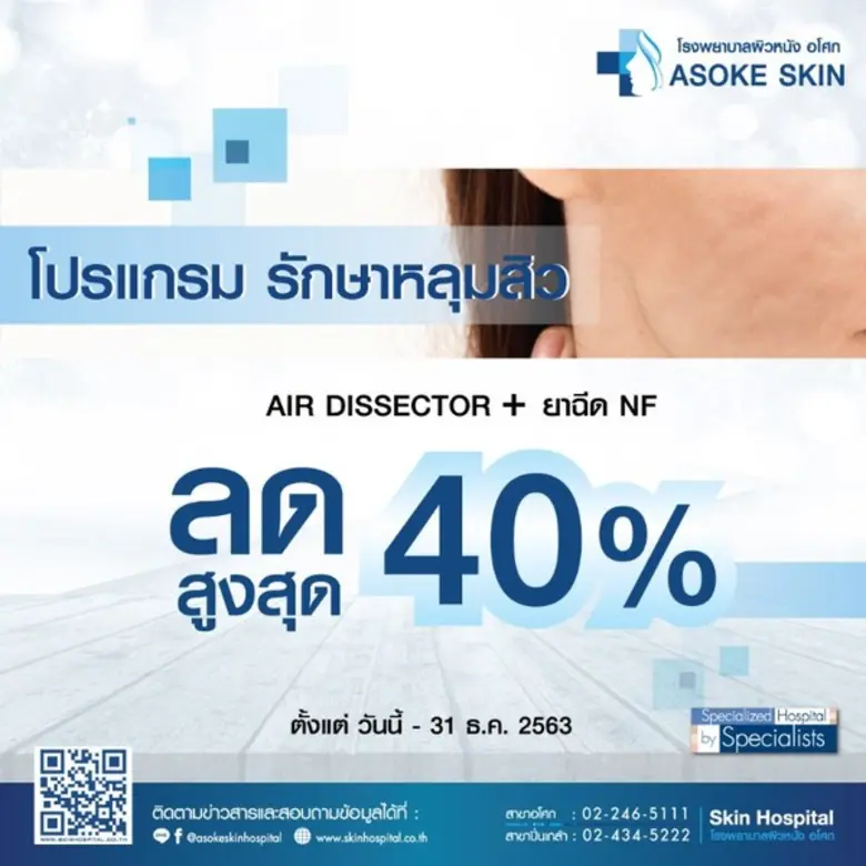 หยุดปัญหาหลุมสิวบนใบหน้า โรงพยาบาลผิวหนัง...