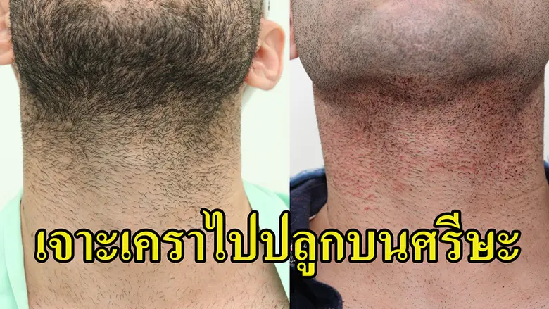 ศ.พญ.กนกวลัย กุลทนันทน์ นายกสมาคมแพทย์ผิวหนังฯ  ยุคของการเปลี่ยนแปลงของโลกยุคปัจจุบัน