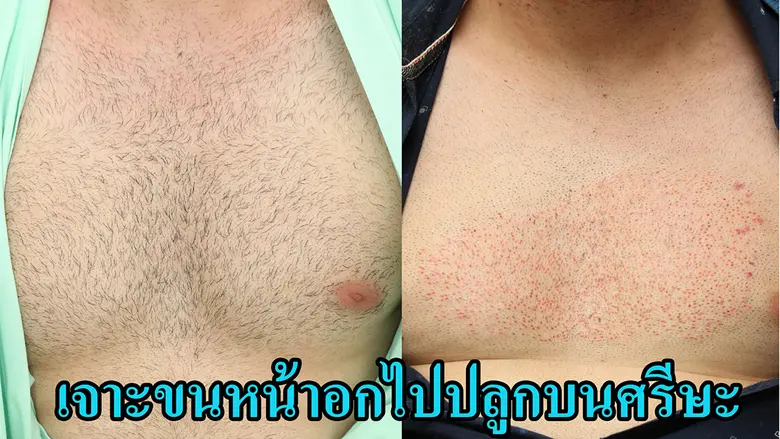 ศ.พญ.กนกวลัย กุลทนันทน์ นายกสมาคมแพทย์ผิวหนังฯ  ยุคของการเปลี่ยนแปลงของโลกยุคปัจจุบัน