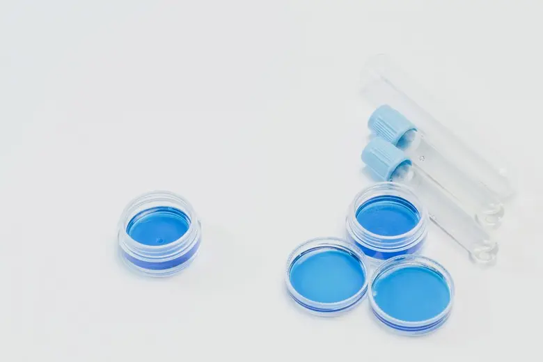 “โรคธาลัสซีเมีย” มรดกถ่ายทอดจากพ่อแม่สู่ลูก วางแผนครอบครัวก่อนแต่งงานมีบุตร ลดการเกิดผู้ป่วยรายใหม่