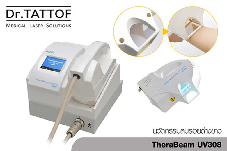 ลบรอยด่างขาว ที่ Dr.TATTOF CLINIC ด้วยนวัตกรรม TheraBeamUV308